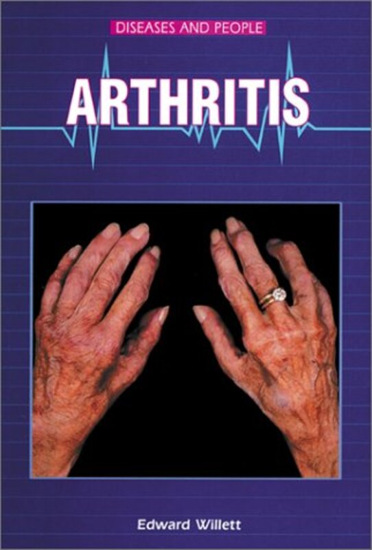 Book cover for "Arthritis" by Edward Willett