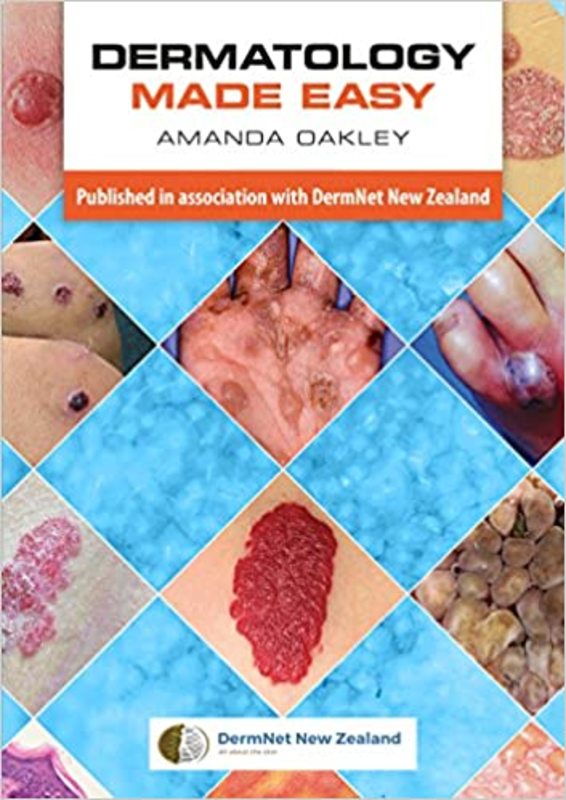 Book cover for "Dermatology Made Easy" by Amanda Oakley