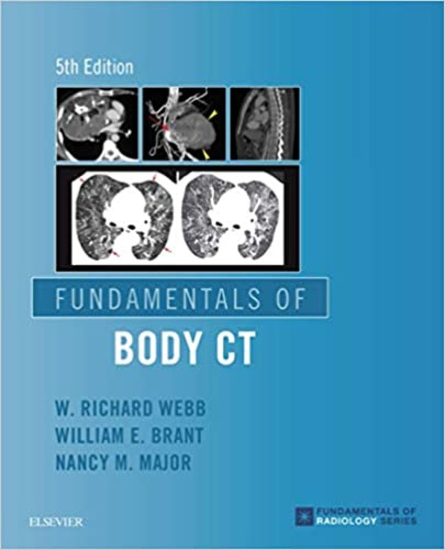 Book cover for "Fundamentals of Body CT" by W. Richard Webb MD
