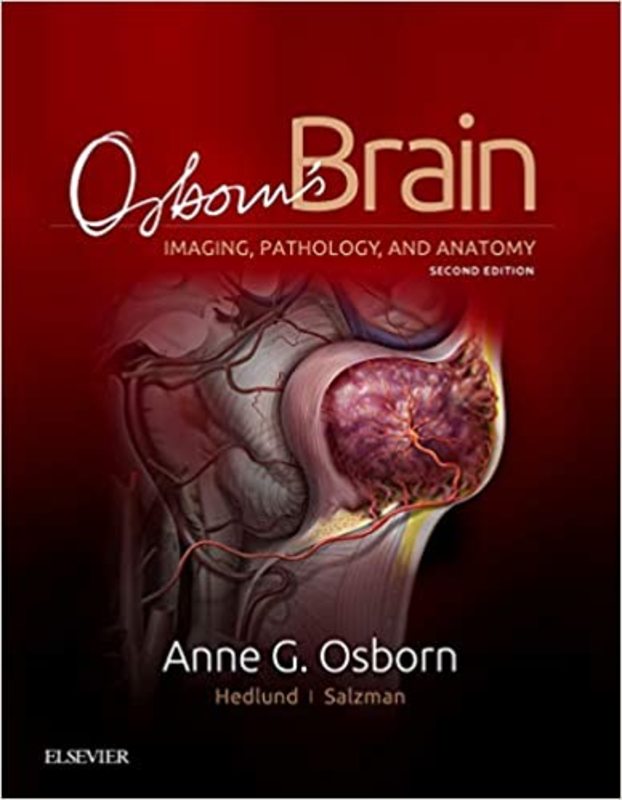 Book cover for "Osborn's Brain" by Anne G. Osborn MD FACR