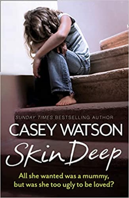 Book cover for "Skin Deep" by Casey Watson