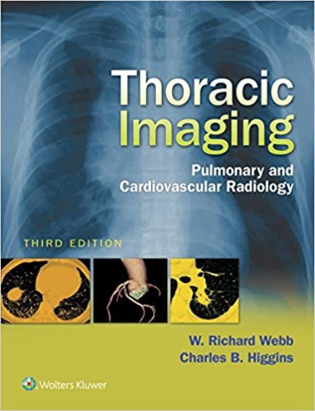 Book cover for "Thoracic Imaging" by W. Richard Webb MD