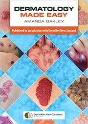 Book cover for "Dermatology Made Easy" by Amanda Oakley
