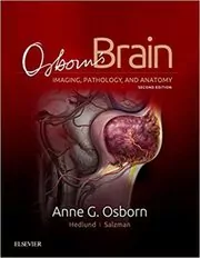 Book cover for "Osborn's Brain" by Anne G. Osborn MD FACR