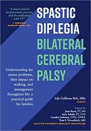 Spastic Diplegia--Bilateral Cerebral Palsy